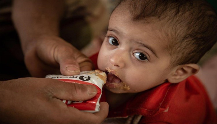 Población yemenita sufre inseguridad alimentaria