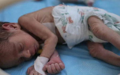 El hambre golpea a las embarazadas y a los niños en Gaza