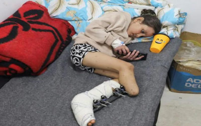 Crisis de medicamentos provocó aumento de amputaciones en Gaza