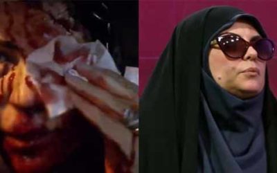 Periodista iraní relata cómo resultó herida por disparo de terroristas