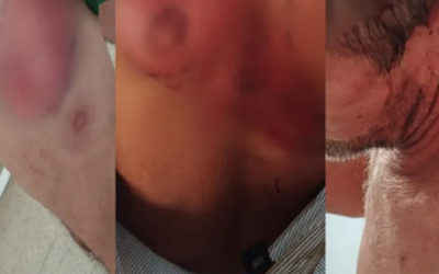 Campesinos denuncian tortura y amenazas para despojarlos de tierras entregadas por la ANT en Meta